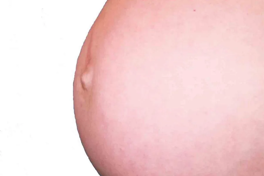 Gravid mage. Foto.